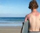 Basking in the Sun? Prolonged Exposure Increases Chance of Skin Cancer