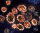 South African scientists detect new virus variant amid spike South African scientists detect new virus variant amid spike