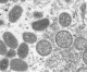 Monkeypox Spreading Through Sex Between Men-WHO Monkeypox Spreading Through Sex Between Men-WHO